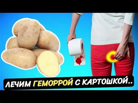 Простая КАРТОШКА поможет избавиться от ГЕМОРРОЯ навсегда! При геморрое ...