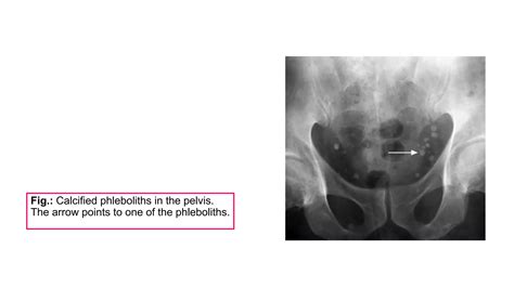 Abdominal Plain.pptx