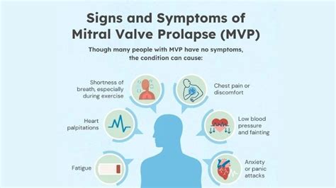 Mitral valve prolapse causes symptoms and treatment