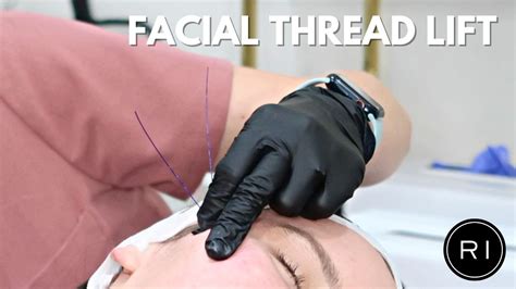 Image result for Cheek Threads