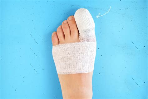 Image result for Toe Bro Splinter