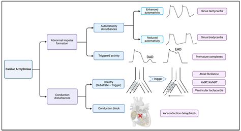 Mitochondrial Dysfunction in Cardiac Arrhythmias