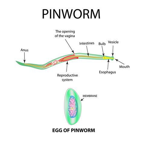 Pinworms Images Photos And Premium High Res Pictures – MUCMV
