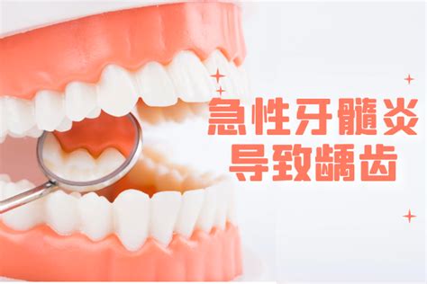 这几个因素可能会导致急性牙髓炎，须多多注意！|急性牙髓炎的原因 - 病症知识 - 轻壹