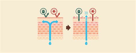 Nummular Dermatitis vs Atopic Dermatitis: Causes and Symptoms – Knya