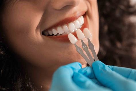 Pros and Cons of Dental Veneers