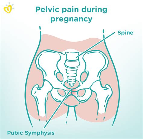 Symphysis Pubis Dysfunction (SPD)—Symptoms and Treatment | Pampers