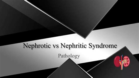 Nephrotic Vs Nephritic