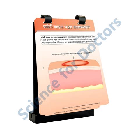 SUPERFICIAL FUNGAL INFECTIONS: A4 Flip Wipe – SMS Scientific Products ...