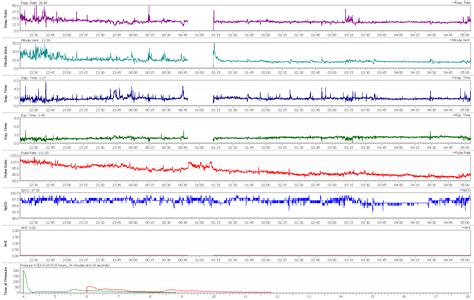 Image result for CPAP Machine Noise