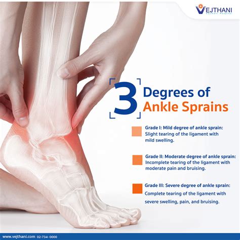 lateral ankle sprain causes: how to fix ankle sprain – ACOITL