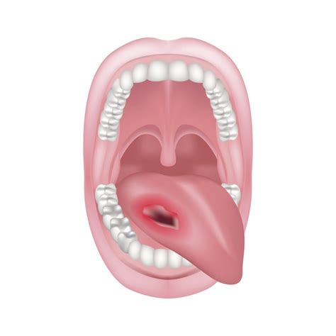 Why Does the Tip of My Tongue Hurt? 6 Possible Causes