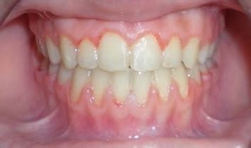 Smile Arc Treatments available in smile arc dental vijayawada
