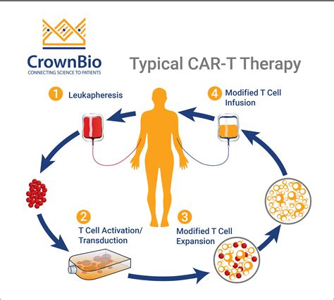 Car T Stem Cell Therapy at Katrina Bates blog