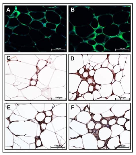 Myristic Acid Supplementation Aggravates High Fat Diet-Induced Adipose ...