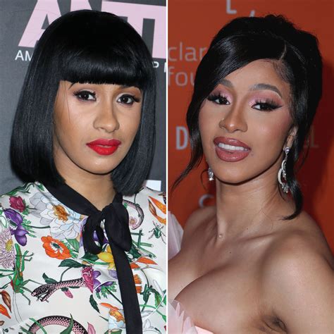 Has Cardi B Had Plastic Surgery? Transformation Photos, Quotes | Life & Style