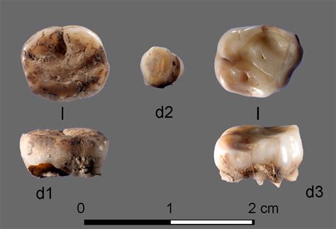 Scientists Found an Unexpected Sign of Human Longevity—Our Teeth
