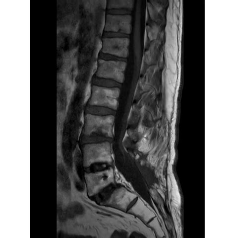 Philips - Compressed SENSE MR Clinical Applications