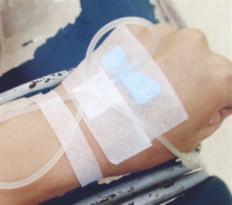 求一个男生输液手部图片 急_百度知道