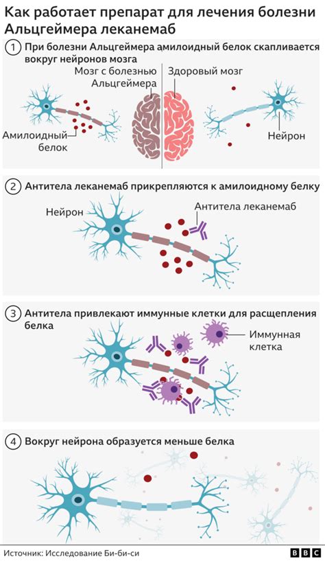 Прорыв в лечении Альцгеймера? Да, если вовремя поставить диагноз - BBC ...