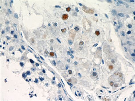 TCF4 antibody (22337-1-AP) | Proteintech