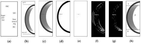 Magnetic Ring Multi-Defect Stereo Detection System Based on Multi ...