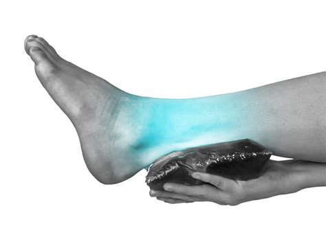 Ankle Sprain (medial / Lateral) - ACE Podiatry