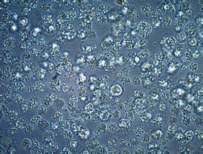 Cell Culture Contamination Troubleshooting