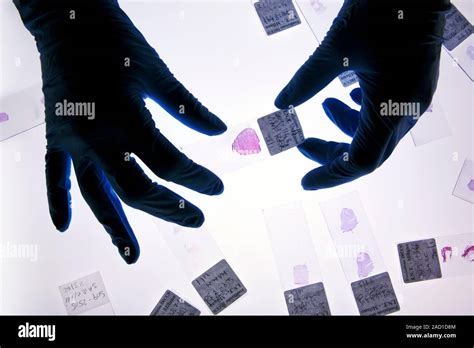 Image result for Tissue Sample Drawing Under Microscope