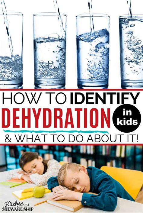 Pediatric Dehydration 的图像结果