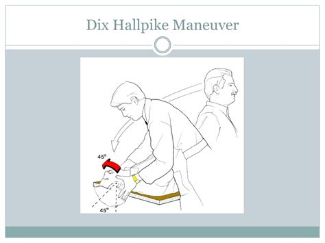 PPT - BPPV: Pathophysiology, Diagnosis, and Facts PowerPoint ...