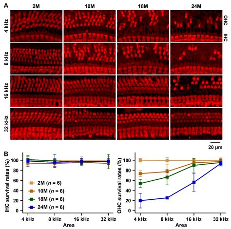 Two Loci Contribute to Age-Related Hearing Loss Resistance in the ...