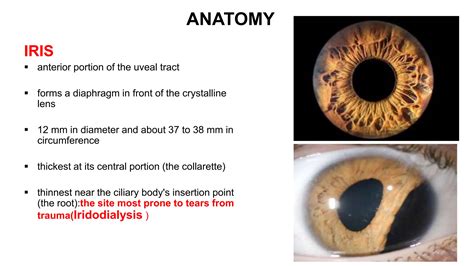 Anatomy of uvea UVEA of ophthalmology.pptx