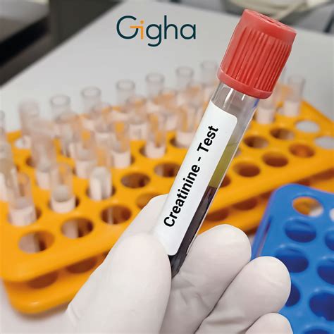 Examen Creatinina en Suero | Comprar en la Tienda Gigha | Soluciones de Gestión Humana para Empresas