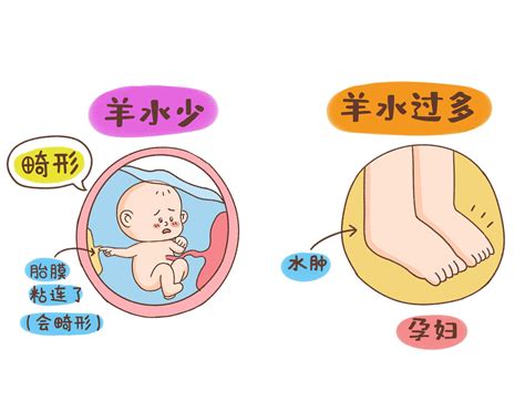 简单易懂, 手把手来教教你如何看懂孕检B超单|胎儿|胎盘|胎囊_新浪新闻