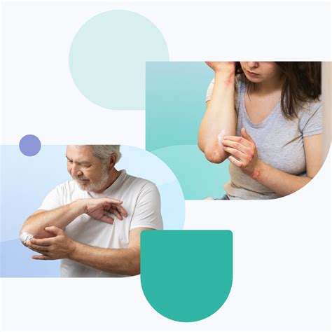 16 over-the-counter psoriasis medications