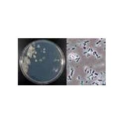 Azotobacter Bio Fertilizer buy in Hyderabad M.Corp