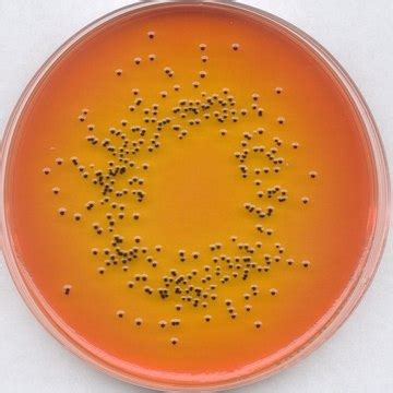 Rappaport-Vassiliadis Broth (RV Broth) - microbial culture media