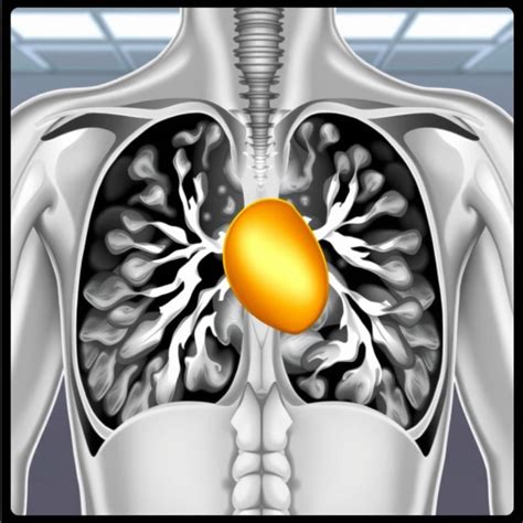 CPT Code CT Chest Without Contrast: Indications, Procedure, and Billing - wmwtl