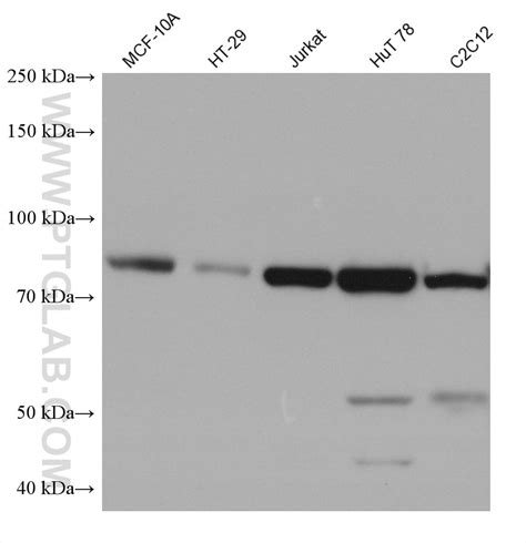 PI3 Kinase p85 Alpha antibody (60225-1-Ig) | Proteintech