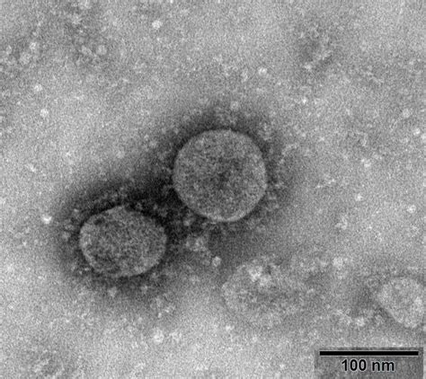 新冠病毒在全球变异成3种毒株 专家警告正快速突变|基因组|新冠肺炎_新浪科技_新浪网