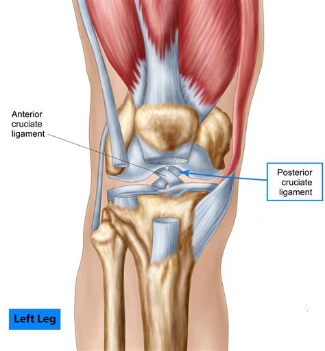 Torn Posterior Cruciate Ligament
