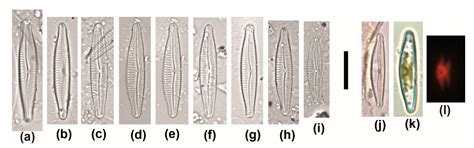 Three New Diatom Species from Spring Habitats in the Northern Apennines ...
