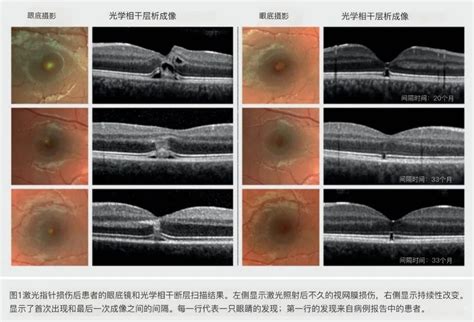 防患于未然，激光对人体危害的机理剖析 _ 德国莱茵tuvrheinland(tuv)