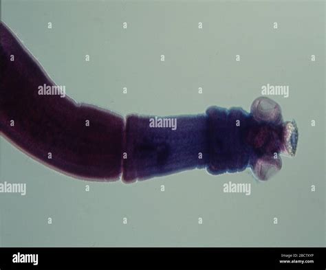 Tapeworm with limbs under the microscope Stock Photo - Alamy