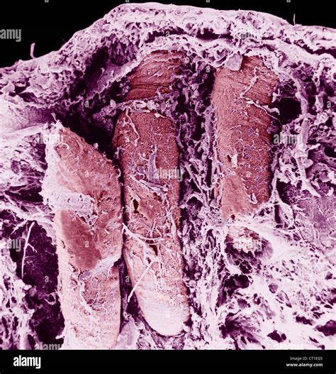 Crypts of lieberkuhn hi-res stock photography and images - Alamy