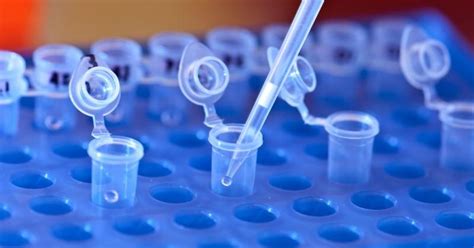 WHO includes Shimla doctor's protocol in new guidelines on rabies ...