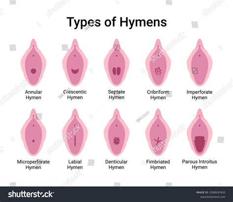 What Does Altar Of Hymen Mean at Raven Goetz blog