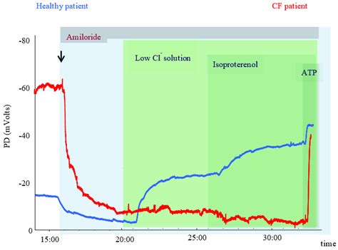 Sweat Chloride Testing and Nasal Potential Difference (NPD) Are Primary ...