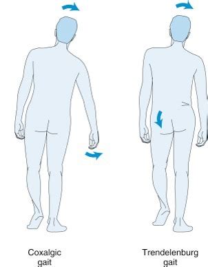 Image result for Contralateral Gait